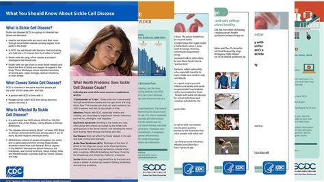 Sickle Cell Trait Resources Sickle Cell Disease Scd Cdc