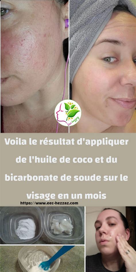 Voila Le R Sultat D Appliquer De L Huile De Coco Et Du Bicarbonate De