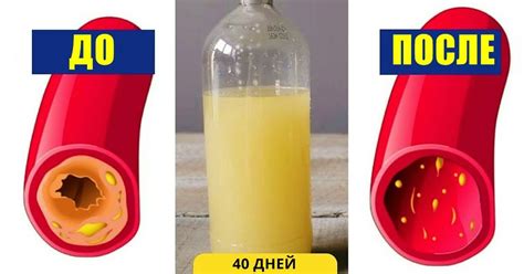 Вот как вычистить сосуды от холестерина за 40 дней без единого ...