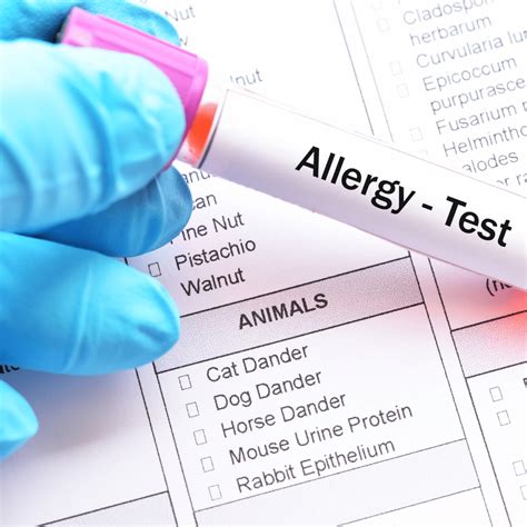 Which Allergy Test Is Right for Me? - Tottori Allergy & Asthma Associates