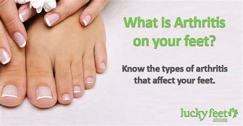 Types Of Arthritis That Affect Your Feet Lucky Feet Shoes