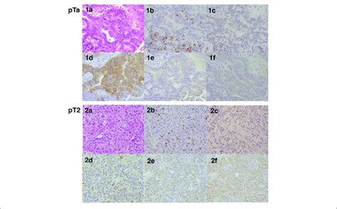 Representative Hematoxylin Eosin And Immunohistochemistry