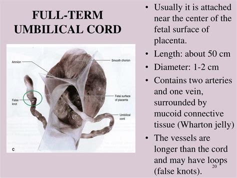 Ppt Placenta Powerpoint Presentation Free Download Id477900