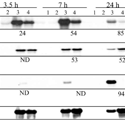 Steady State Mrna Levels In Pbmcs Northern Blot Analysis Of Specific