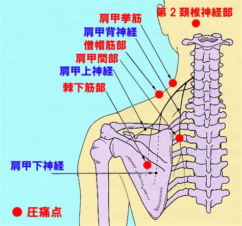 1肩こりに必要な知識 ｜ 内科から見た肩こり みやけ内科・循環器科【総合内科のアプローチ】