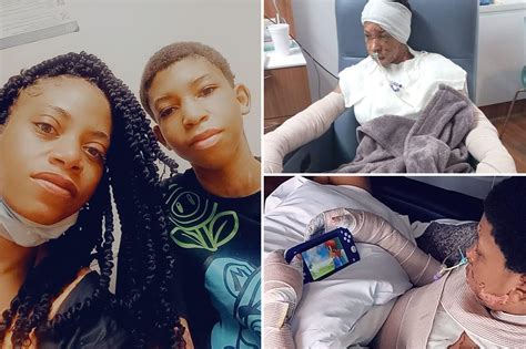 My son caught on fire doing a viral stunt — I tried to put it out with ...