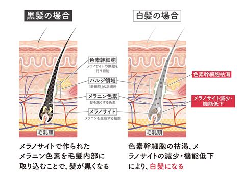 白髪とストレスって関係があるの？