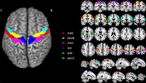 Frontiers Altered Functional Connectivity Between Primary Motor