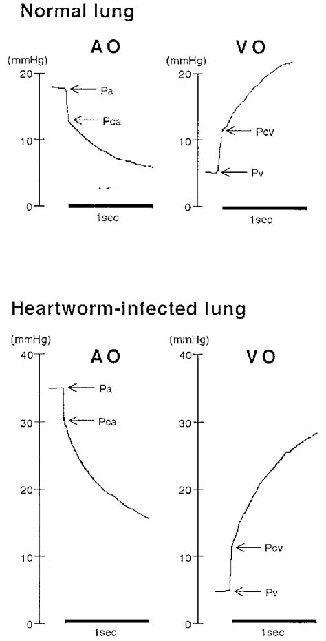 Tracings Of Pulmonary Arterial Pressure Pa With Arterial Occlusion Download Scientific