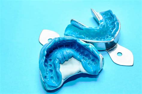 Comparing Types of Dental Impression Materials - STOMADENT