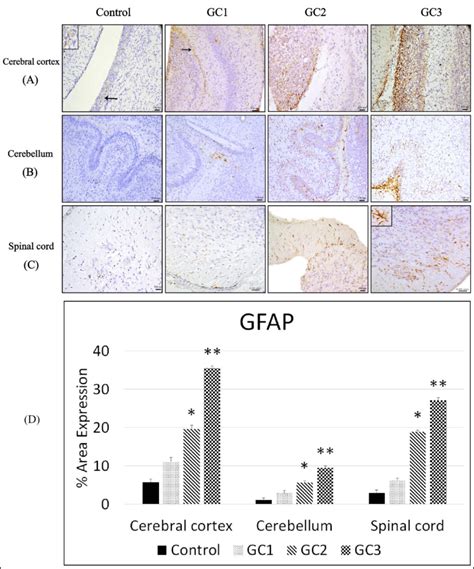 Photomicrographs Showing Immune Expression Of GFAP In The Cerebral