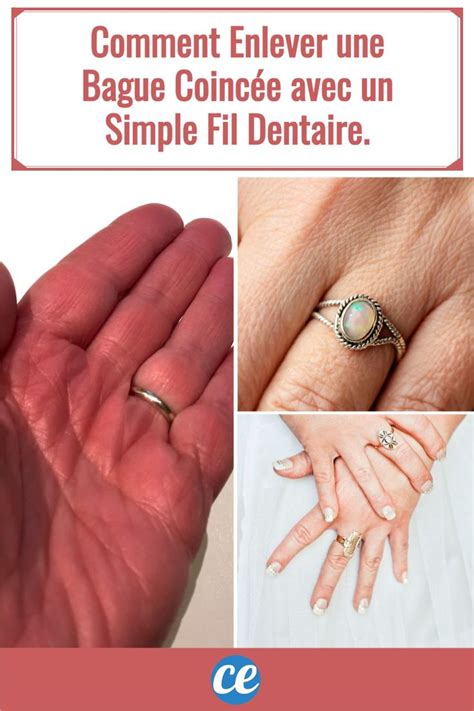 Comment Enlever Une Bague Coinc E Avec Un Simple Fil Dentaire Bague