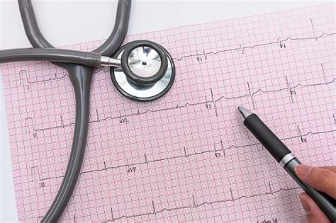 Ecg Interpretation How To Read An Electrocardiogram Usa Medical And