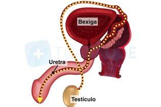 Ejacula O Retr Grada O Que Sintomas Causas E Tratamento Tua Sa De