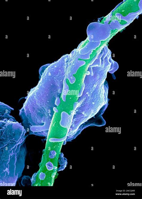 Yeast Infecting A Granulocyte Coloured Scanning Electron Micrograph