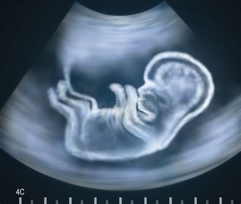 Ultrasound Image Of Baby In Mother S Womb Stock Illustration