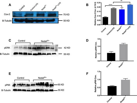 Levels Of Cox 2 Expression And Phosphorylation Levels Of P65 And ERK In