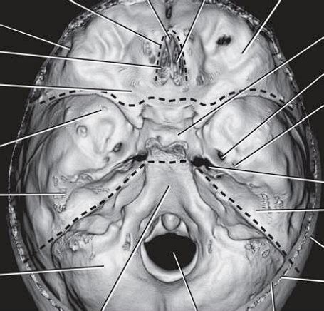 Cranial Fossa Diagram Quizlet