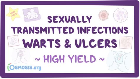 Sexually Transmitted Infections Warts And Ulcers Pathology Review