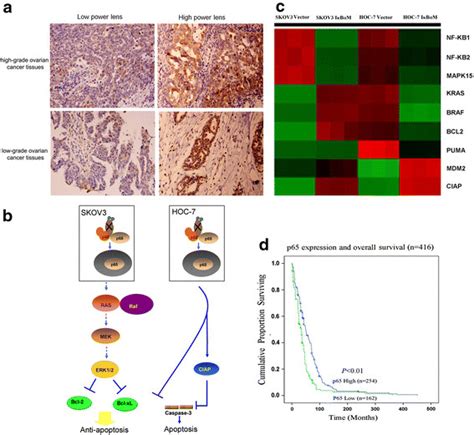 correlation  nuclear localization  p nf kb  clinicopathologic