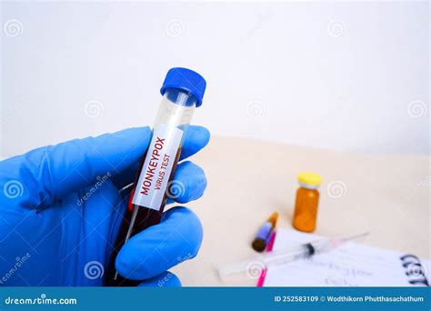 Monkeypox Mpxv Blood Sample In Test Tube Holding By Doctor Hand Stock