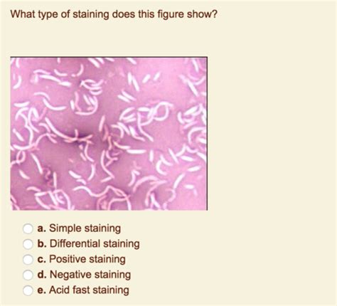 Lab Negative Staining Capsular Stains Gram Staining