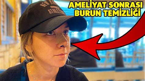 BURUN AMELİYATI SONRASI YAĞLI VE SİVİLCELİ CİLTLER İÇİN ÜRÜN