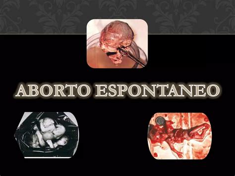 Aborto Espontaneo Ppt