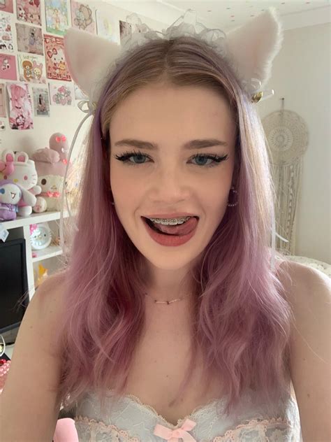 Would You Cum On My Braces R Amature Braces