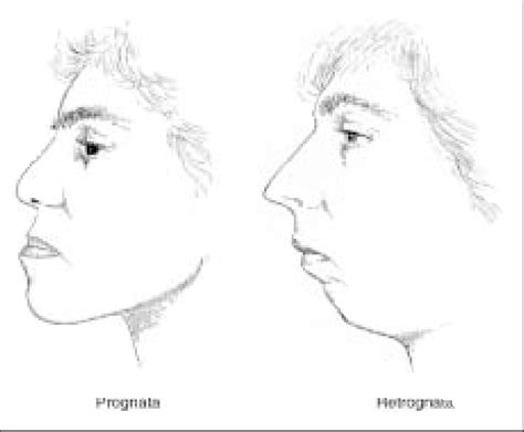 Valoración estructural de los perfiles faciales Download Scientific