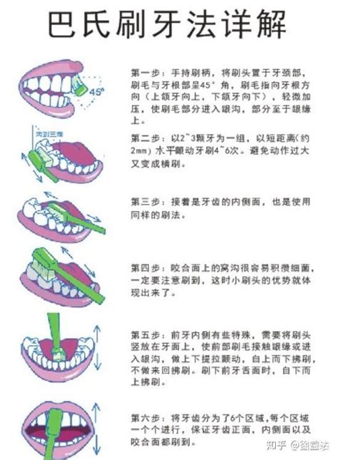 武汉大学口腔医院洗牙，拔牙，补牙，牙周炎深度洁牙（龈下刮治）记录 知乎