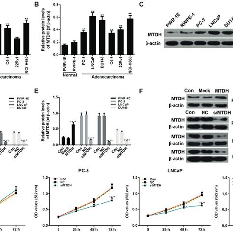 Expression Of Mtdh In Prostate Cancer Pca Tissues And Adjacent Normal