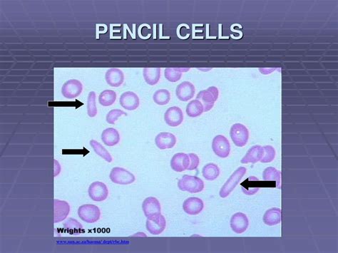 Ppt Core Area 4 Haematology Group C Powerpoint Presentation Free