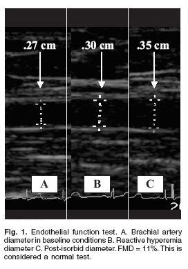 Non Invasive Assessment Of Endothelial Function Intra And Inter