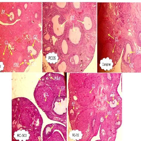 Histological Sections Of Rat Ovary Were Stained With Hematoxylin And