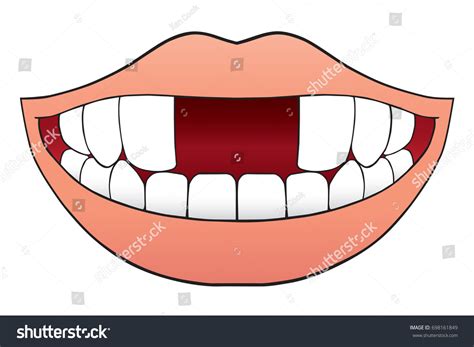 Smiling Cartoon Mouth Two Front Teeth Stock Vector 698161849 - Shutterstock