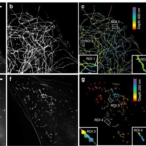 Multi Angle Interference Imaging Of Microtubules And Peroxisomes