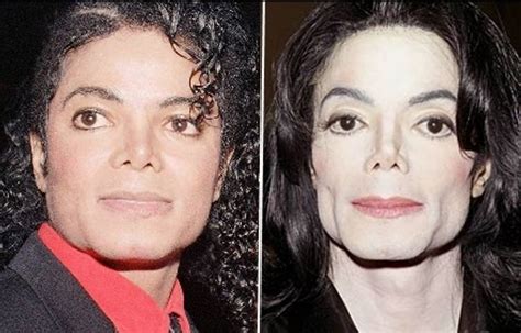 Michael Jackson before and after plastic surgery (2) – Celebrity plastic surgery online