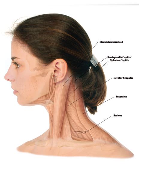 Distonia Cervical