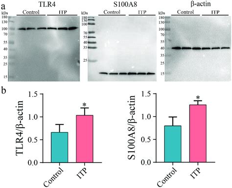 Determining The Protein Levels Of Tlr And S A A The Protein