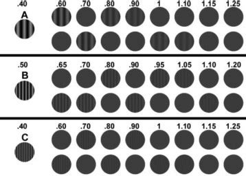 Test de Sensibilidad al Contraste CSV 1000 Institut Català de Retina