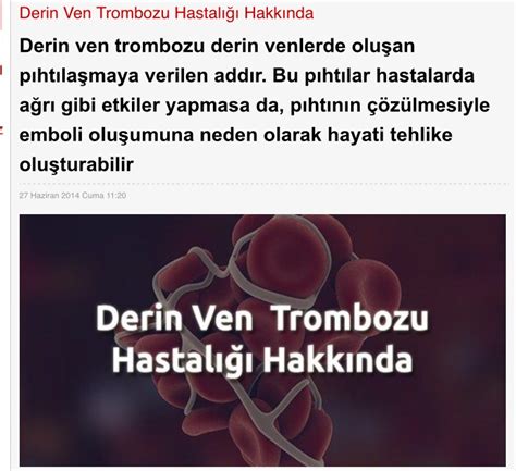 Prof Dr Ahmet Akgül Derin ven trombozu DVT nedir