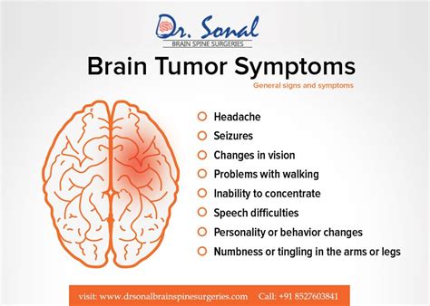 Brain Tumor Sinus Headache - Headache