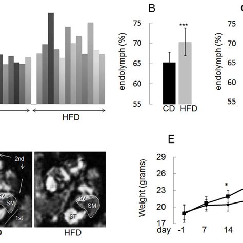 High Fat Diet Hfd Feeding Induces Expansion Of The Endolymphatic