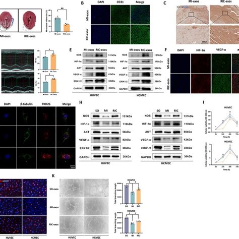 Effect Of Exosomes On Angiogenic Capability Of Endothelial Cells A