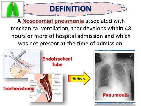 Ventilation Associated Pneumonia [vap]