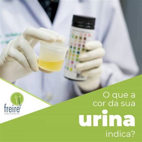 O Que A Cor Da Sua Urina Indica Labfreire