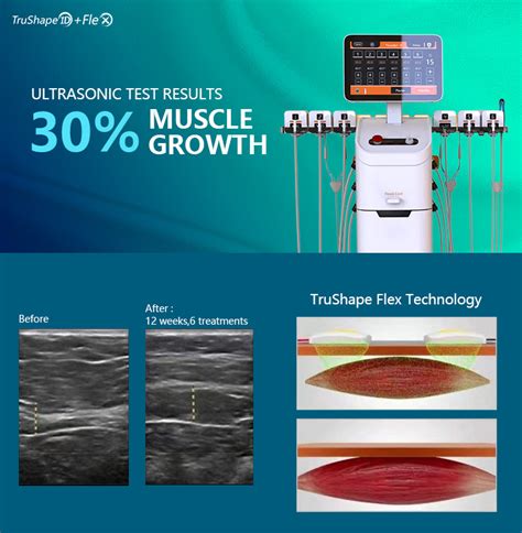 2023 Trusculpt Flex 3D Tru Sculpt ID RF Monopolar Therapy Machine