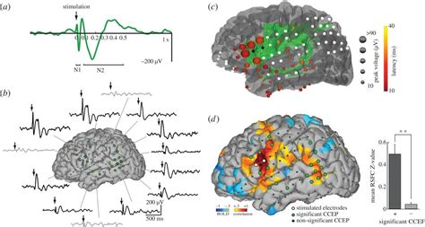 Mapping Human Brain Networks With Cortico Cortical Evoked Potentials