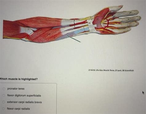 Solved Copyright Som Which Muscle Is Highlighted Dorsal Chegg